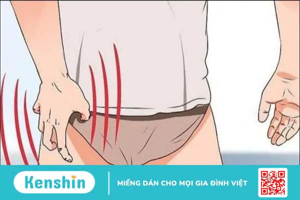 5 cách mặc quần lọt khe đúng cách, tránh gây hại cho vùng kín