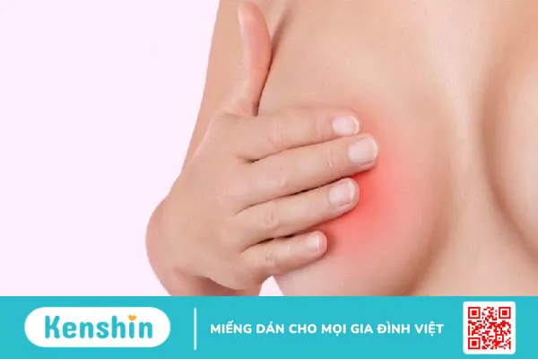 5 dấu hiệu áp xe vú giúp bạn nhận biết bệnh chính xác