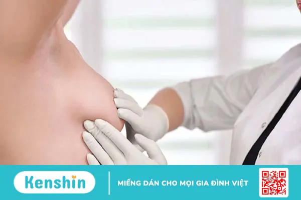 5 dấu hiệu áp xe vú giúp bạn nhận biết bệnh chính xác