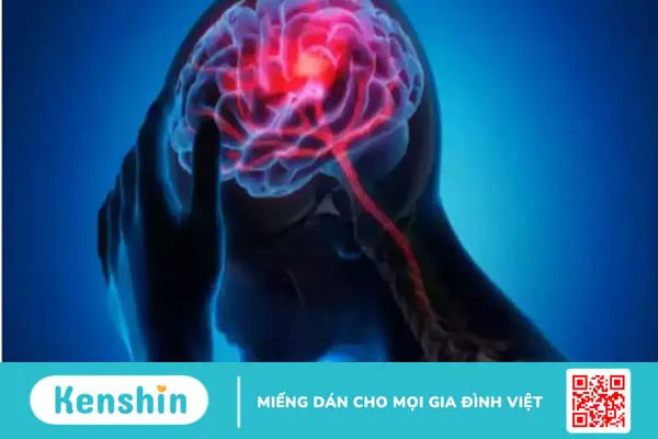 5 dấu hiệu nhận biết đột quỵ trước 30 ngày, cách sơ cấp cứu kịp thời