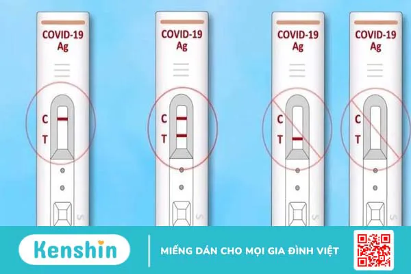 5 lý do nên dùng bộ xét nghiệm nhanh COVID-19 tại nhà