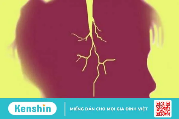 5 triệu chứng Alzheimer phổ biến bạn không thể bỏ qua