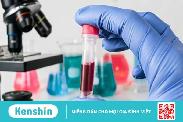 5 triệu chứng sốt phát ban giúp bạn nhận biết bệnh chính xác