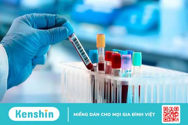 5 triệu chứng viêm phổi giúp bạn nhận biết bệnh chính xác