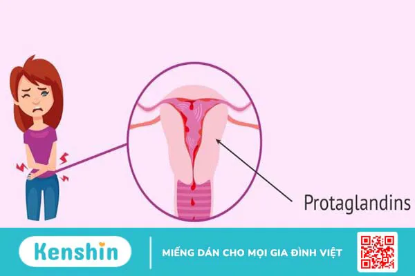 5 tư thế nằm giúp giảm đau bụng kinh, đau lưng khi đến tháng