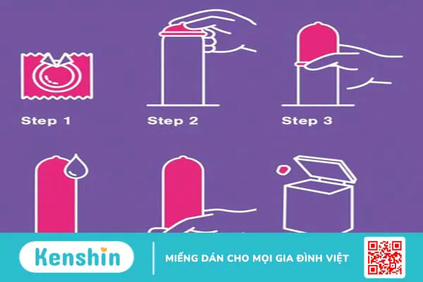 6 cách phòng tránh bệnh lây qua đường tình dục không nên bỏ qua!