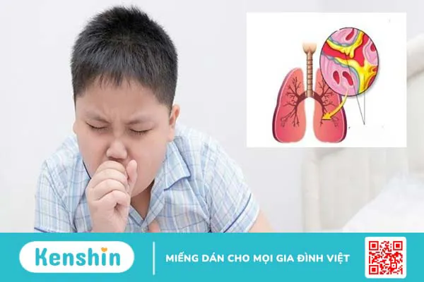 6 lý do bạn còn triệu chứng ho dù đã hết mắc Covid-19