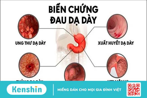 6 nhóm thuốc dạ dày hiệu quả nhất hiện nay và lưu ý khi sử dụng thuốc