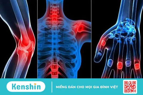 6 tác dụng của lá thường xuân đối với sức khỏe bạn cần biết