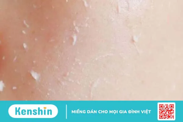 6 tác dụng của yến mạch đối với làn da