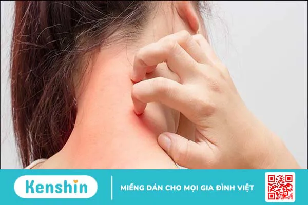 6 tác hại của quế khi dùng không đúng cách – 3 lưu ý an toàn sức khỏe