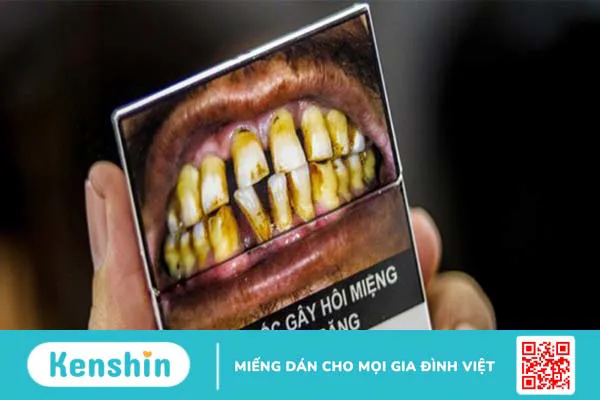 6 thói quen tốt cho răng miệng bạn cần biết