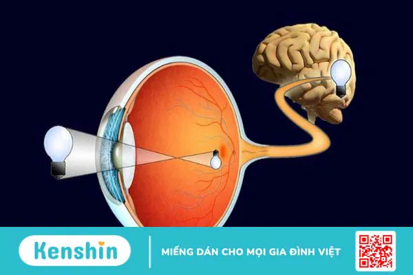 7 biến chứng của bệnh tiểu đường lên mắt và các biện pháp phòng ngừa