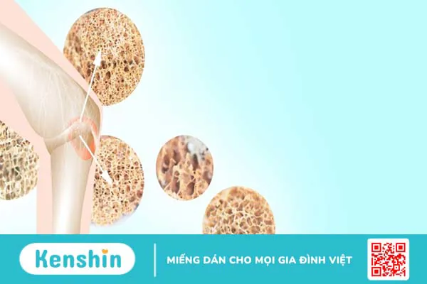 7 biến chứng viêm ruột bạn không nên bỏ qua