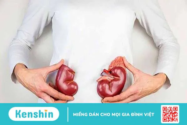 7 biến chứng viêm ruột bạn không nên bỏ qua