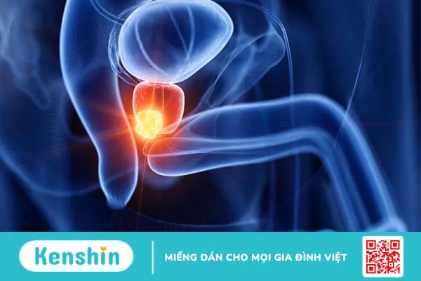 7 công dụng của sài đất đối với sức khỏe bạn nên biết