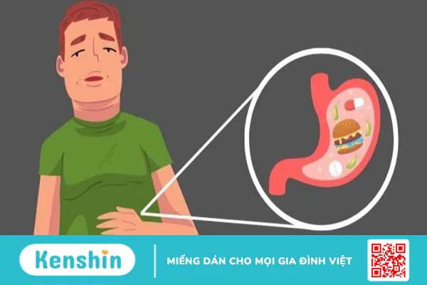 7 dấu hiệu ung thư dạ dày thường gặp nhất không nên chủ quan