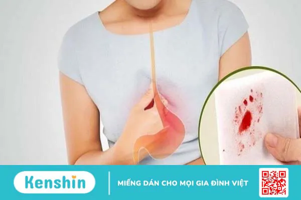 7 dấu hiệu ung thư dạ dày thường gặp nhất không nên chủ quan