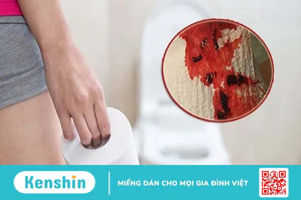 7 dấu hiệu ung thư dạ dày thường gặp nhất không nên chủ quan