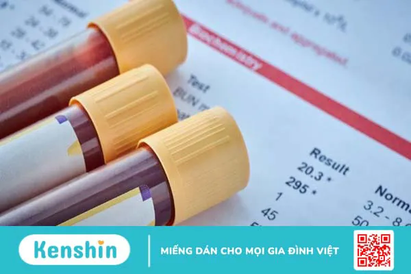 7 nguyên nhân ngứa họng cần biết để phòng tránh