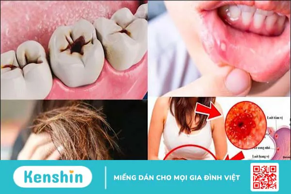 7 tác dụng giảm cân của nước chanh bạn không nên bỏ qua