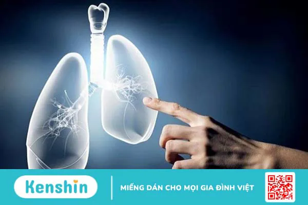 8 bài tập thở hậu covid và một số mẹo giúp phổi khỏe mạnh