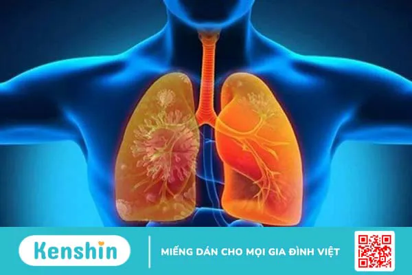 8 biến chứng bệnh thủy đậu gây nguy hiểm, bố mẹ không nên chủ quan