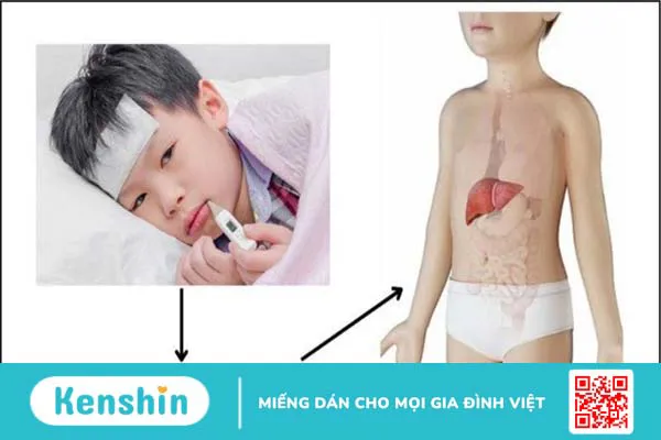 8 biến chứng bệnh thủy đậu gây nguy hiểm, bố mẹ không nên chủ quan