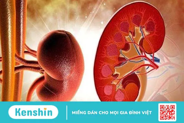 8 biến chứng bệnh thủy đậu gây nguy hiểm, bố mẹ không nên chủ quan