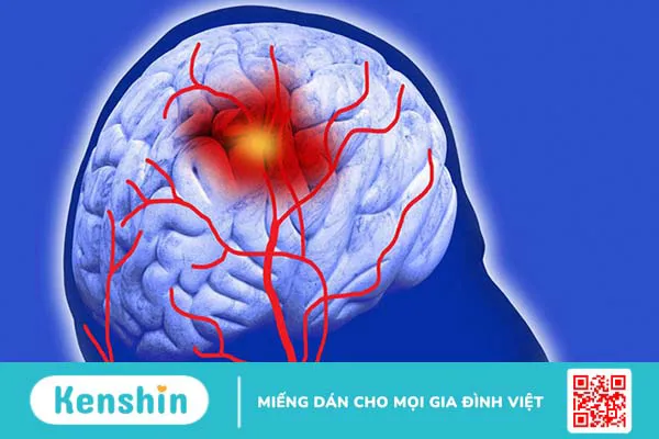 8 biến chứng suy gan nguy hiểm bạn không nên coi thường