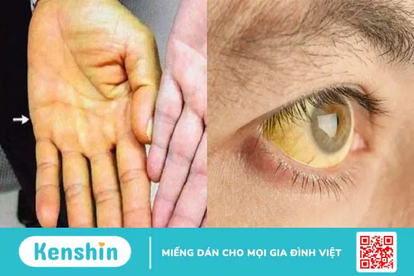 8 cách giải độc gan tại nhà đơn giản, hiệu quả dịp lễ bạn có thể biết