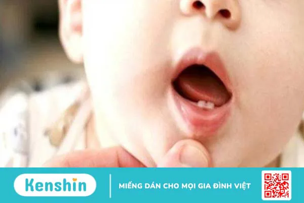 8 cách hạ sốt cho trẻ sơ sinh, trẻ nhỏ và lưu ý khi chăm sóc bé bị sốt