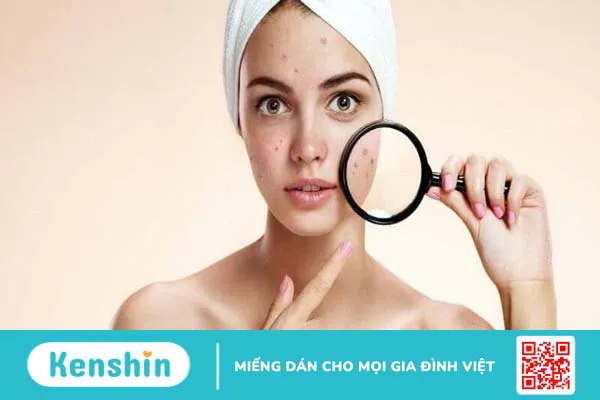 8 cách làm mặt nạ tinh bột nghệ đơn giản. Có nên đắp hàng ngày không?