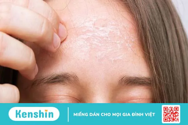 8 cách làm mặt nạ tinh bột nghệ đơn giản. Có nên đắp hàng ngày không?