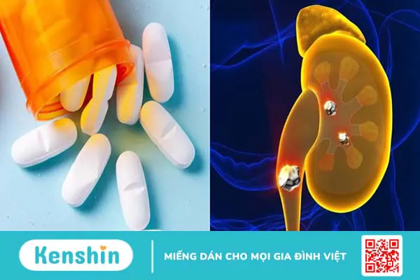 8 cách phòng bệnh sỏi niệu quản tại nhà hiệu quả bạn nên biết