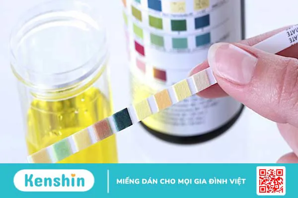 8 cách trị sỏi thận tại nhà đơn giản, an toàn không cần thuốc