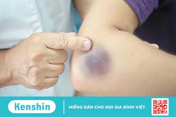 8 dấu hiệu lão hóa sớm mà bạn cần lưu ý