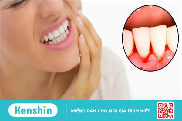 8 dấu hiệu nhận biết sớm ung thư nướu răng và cách điều trị