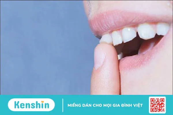 8 dấu hiệu nhận biết sớm ung thư nướu răng và cách điều trị