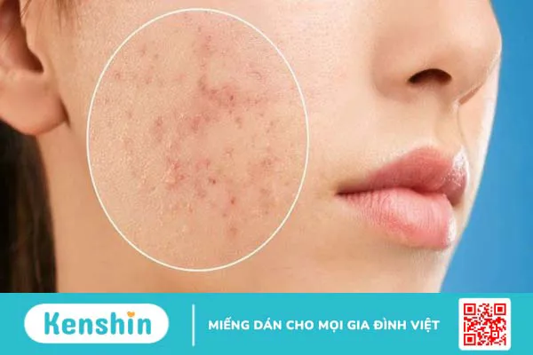 8 lợi ích của astaxanthin đối với sức khỏe làn da bạn nên biết