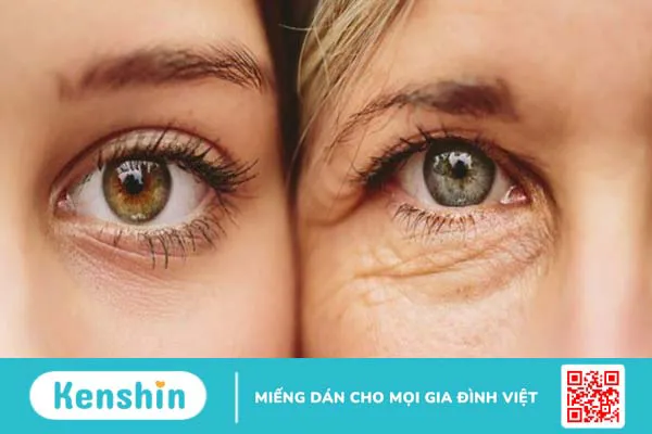 8 lợi ích của astaxanthin đối với sức khỏe làn da bạn nên biết