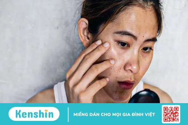 8 lợi ích của astaxanthin đối với sức khỏe làn da bạn nên biết