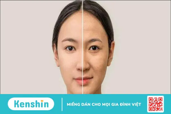 8 lợi ích của lựu đối với làn da bạn nên biết