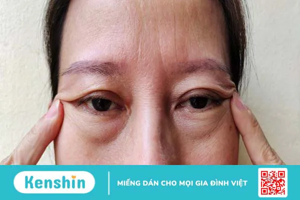 8 lợi ích của trà xanh đối với sức khỏe làn da bạn nên biết