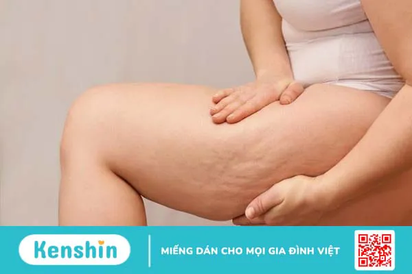 8 lợi ích của trà xanh đối với sức khỏe làn da bạn nên biết