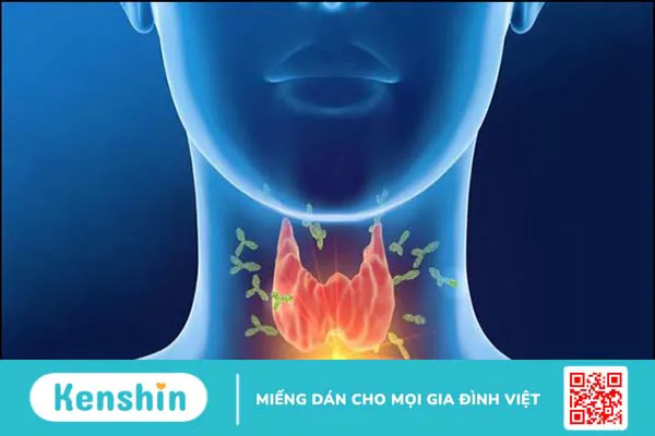 8 nguyên nhân béo phì ở trẻ em mà bố mẹ không nên bỏ qua