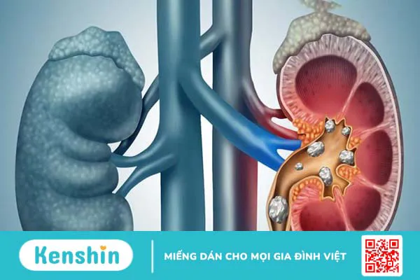 8 tác hại của quả sung – những người không nên ăn quả sung