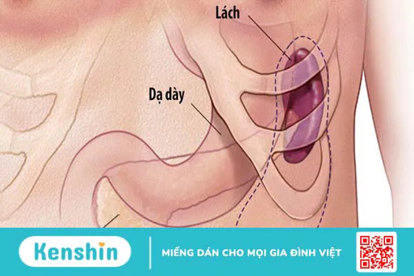 8 triệu chứng bệnh bạch cầu giúp bạn kịp thời phát hiện ra bệnh