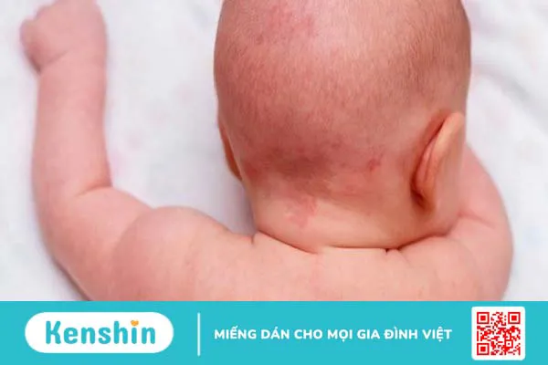 8 triệu chứng rối loạn tiêu hoá ở trẻ bố mẹ nên lưu ý và cách điều trị