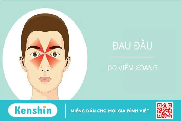 8 triệu chứng viêm xoang giúp bạn nhận biết bệnh nhanh chóng